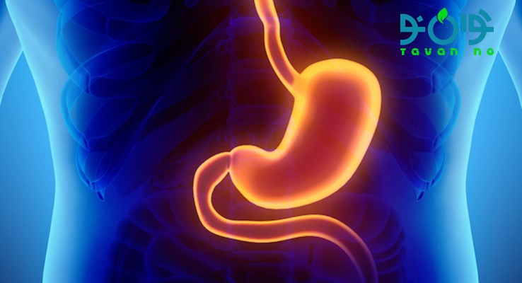 درمان گیاهی التهاب معده مزمن